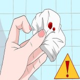 خونریزی شقاق مقعدی خطرناک است؟! + روشهای جلوگیری