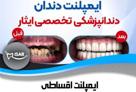 خدمات مرکز زراعة الأسنان