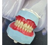 ساخت انواع دندان مصنوعی،ساخت پلاک کروم کبالت براساس فک،ساخت پروتز فلکسی و…