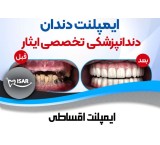 خدمات مرکز زراعة الأسنان