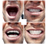 طب أسنان بارسیل