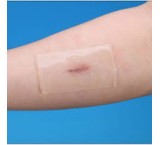 inkaskincare suture and wound healing tape