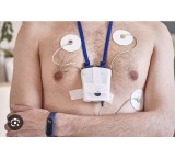 انجام هولتر ضربان و فشار خون