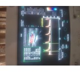 General Electric Ultrasound Device for Varicose Veins + GE Vivid 3