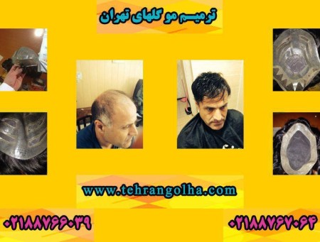 ترمیم مو گلهای تهران نماینده رسمی های فیکس آلمان