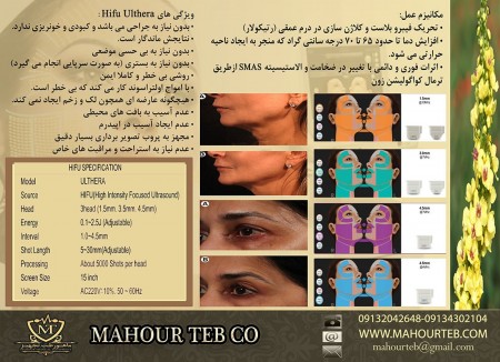 Special sale of Haifu Ultra device with interest-free installments of