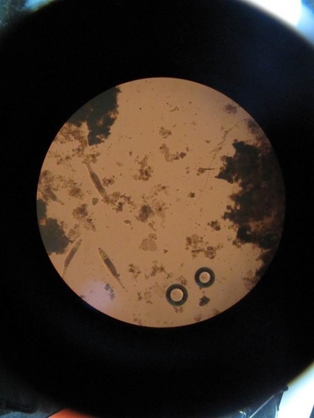 باکتری خشک (لجن خشک)