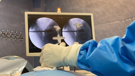 درمان سیاتیک و دیسک کمر بدون جراحی