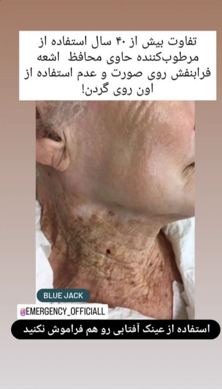خدمات پاکسازی وفیشال پوست