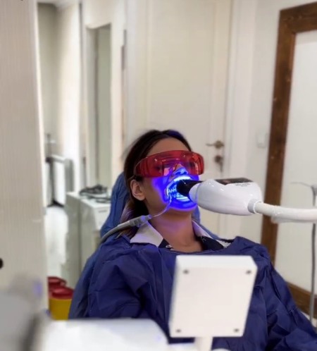 تخفیف -بلیچینگ