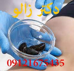 فروش و پرورش زالوی طبی با مجوز رسمی از دامپزشکی استان البرز، کرج