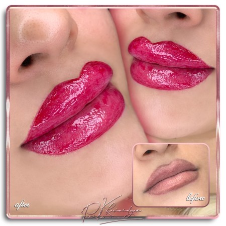 میکروپیگمنتیشن لب