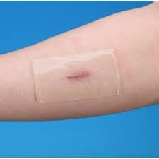 inkaskincare suture and wound healing tape