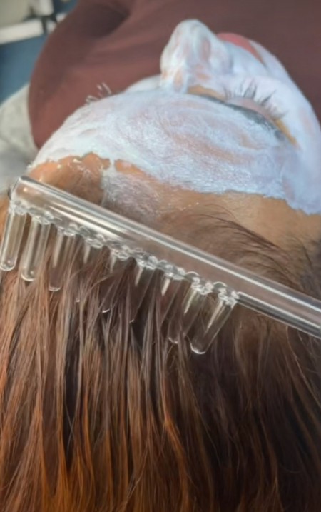 خدمات پاکسازی پوست توسط افراد مجرب با متریال مرغوب