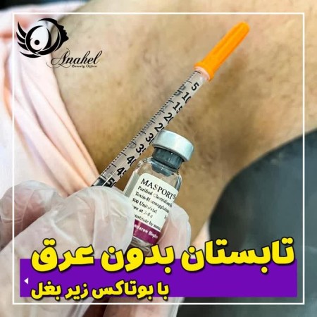 Underarm botox with 40% discount