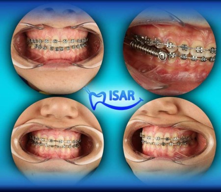 Dental orthodontic service center
