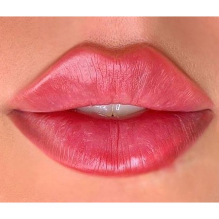 Gel and botox injections