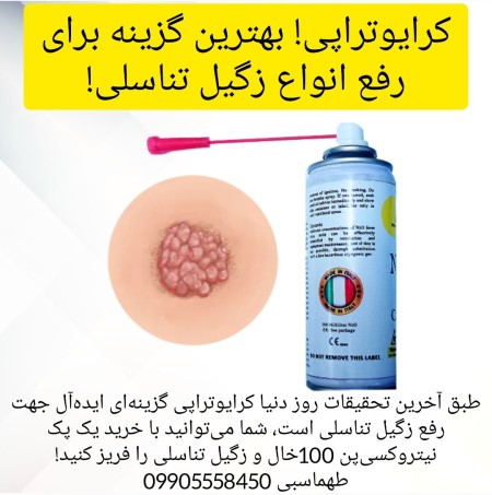 Sale of cryo spray for genital wart treatment