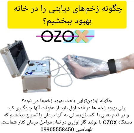 Ozone therapy device for treating diabetic wounds and de-infection