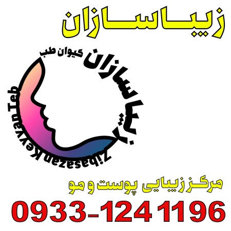 Model for HIFU facial beautification of Kivan Teb