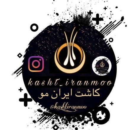 Blepharoplasty (correcting sagging eyelids)