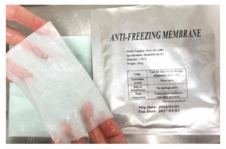 Buy 110 grams of ice chryolipolysis pad
