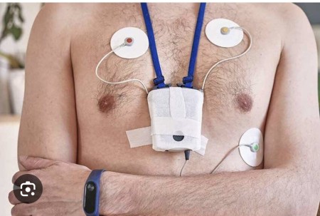 انجام هولتر ضربان و فشار خون