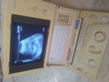 دستگاه سونوگرافی پرتابل توشیبا