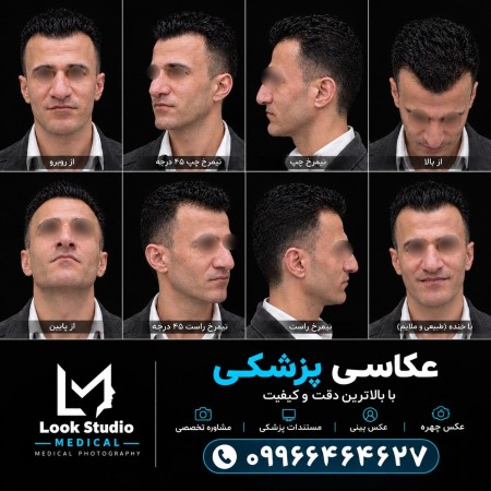 فتوگرافی پزشکی لوک