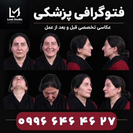 فتوگرافی پزشکی لوک