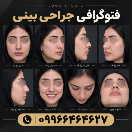 فتوگرافی پزشکی لوک