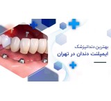 کلینیک ایمپلنت دندان